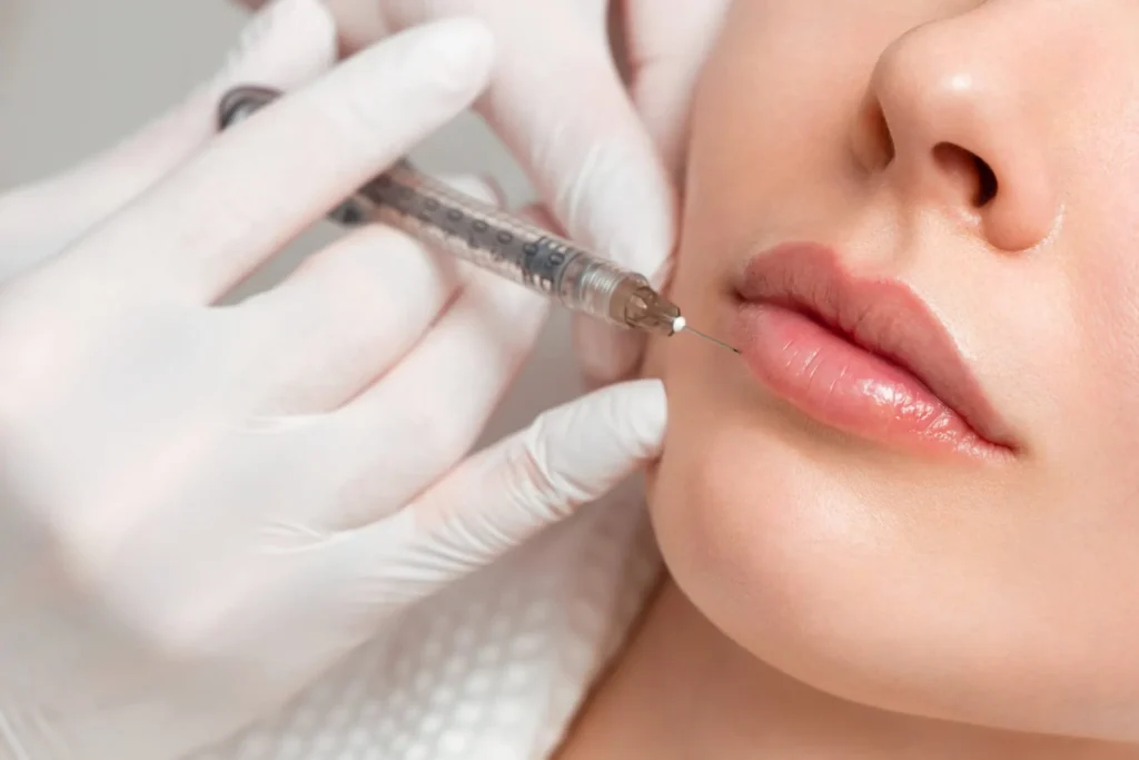 Dermal_filler