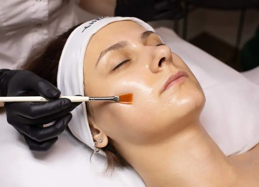 BioRePeel in St. Louis, MO | The Method Aesthetics & Wellness